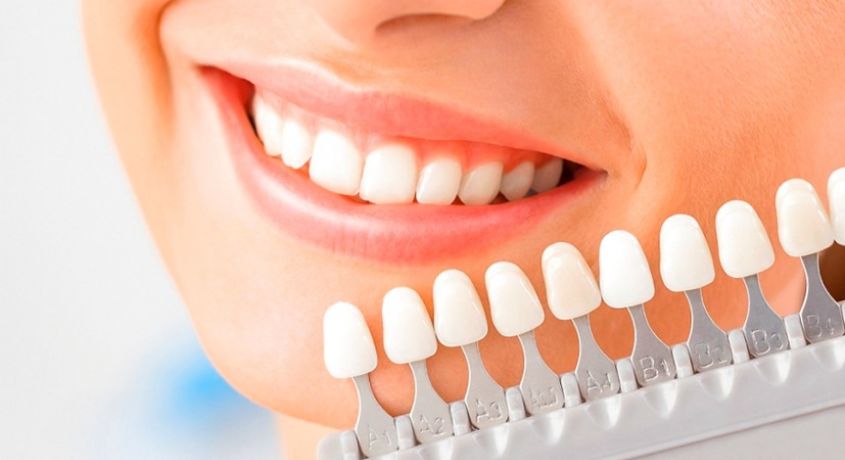 Улыбнись лету! Скидка 60% на отбеливание зубов от стоматологической клиники «Стоматология Для Всех».