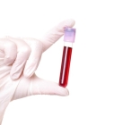 Профильное биохимическое исследование крови 