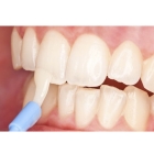 Лечение чувствительности зубов фторлак