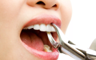Удаление подвижного зуба