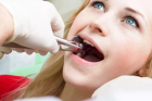 Удаление нижних зубов