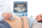 УЗИ при многоплодной беременности 1 триместра