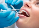 Лечение зуба под коронкой  