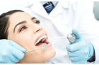 Снятие шинирующей конструкции (включая удаление пломбировочного материала, полирование зубов, область 3-х зубов)
