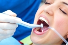 Удаление молочного зуба, резко подвижного зуба, фрактура зуба