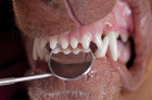 Экстракция однокоренного зуба