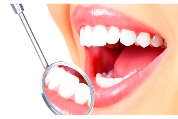 Лечение некариозных поражений тканей зуба с постановкой пломбы световой полимеризации