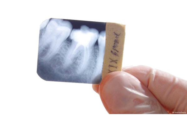 Повторное рентгенологическое исследование 1 зуба