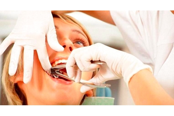 Удаление постоянного зуба с анестезией простое