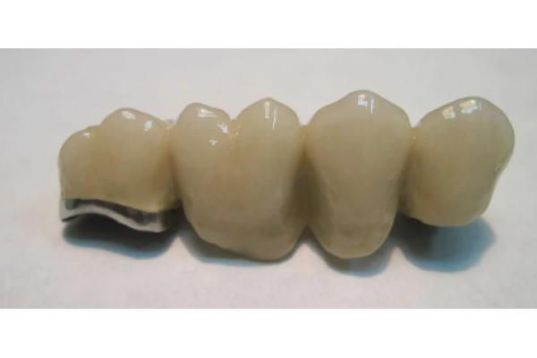 Коронки Томск Заречная 1-я эликсир томск стоматология отзывы