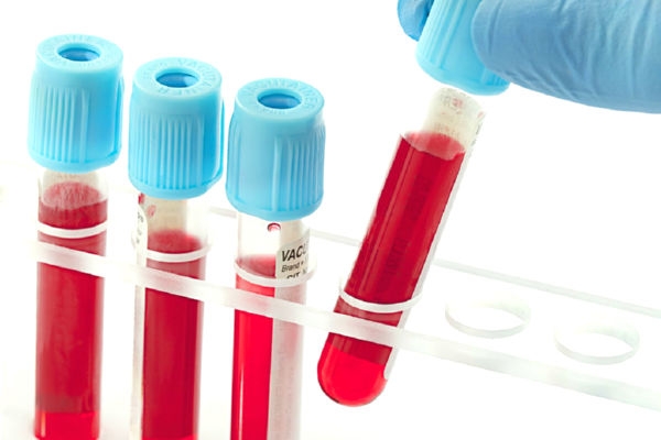 Анализ крови на гепатит