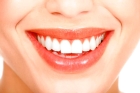 Косметическая пластинка 1-3 зуба