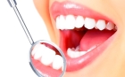 Лечение некариозных поражений тканей зуба с постановкой пломбы световой полимеризации