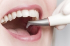 Профессиональная гигиена полости рта и зубов «Air flow» 