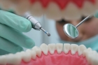 Лечение постоянных зубов
