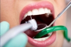Лечение эмали зубов 