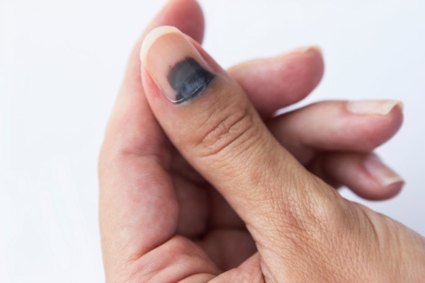Что означают черные ногти и чего стоит опасаться?